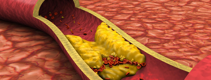 banniere_cholesterol