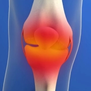 laboratoire-dissolvurol-arthrose du genou